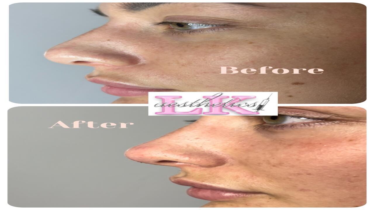 LK Aesthetics image 2