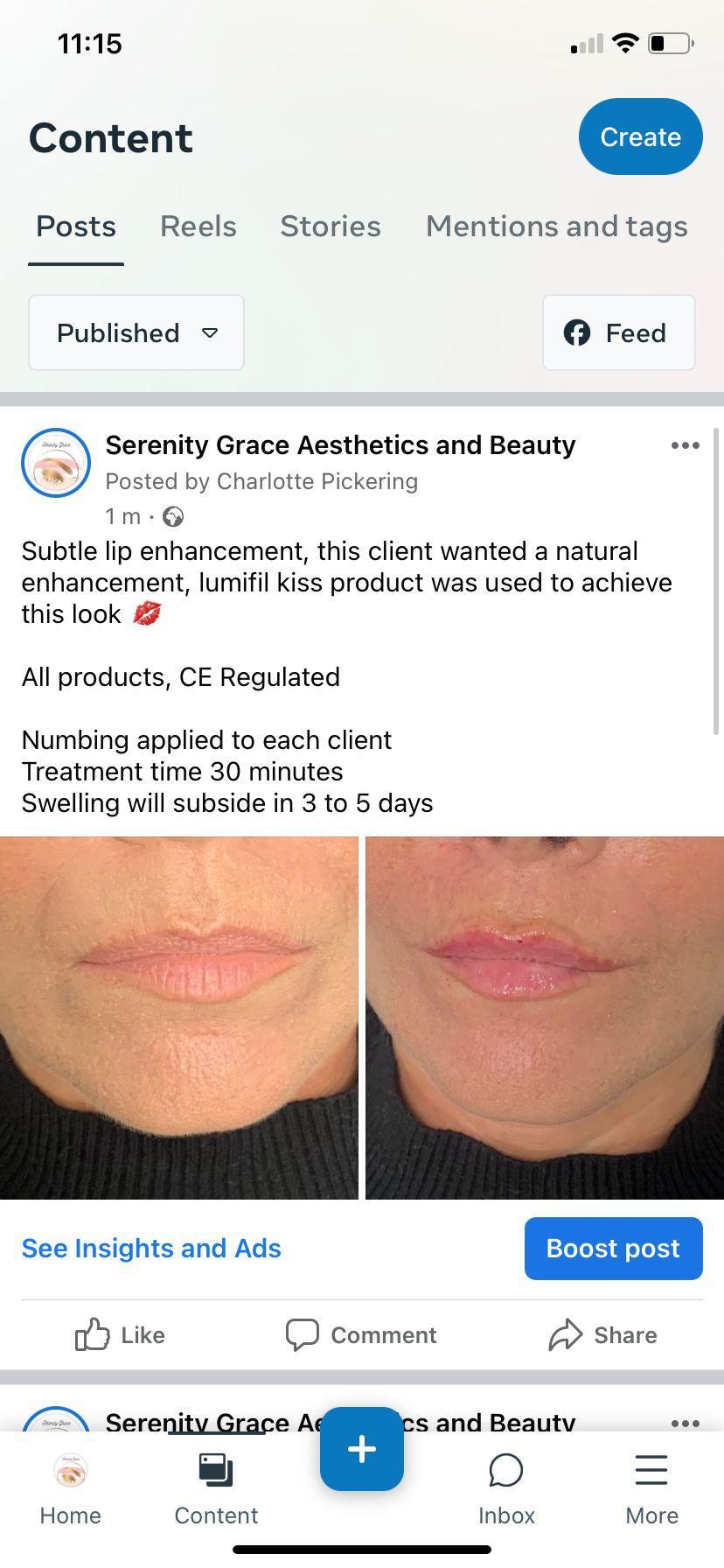 Serenity Grace Aesthetics image 2