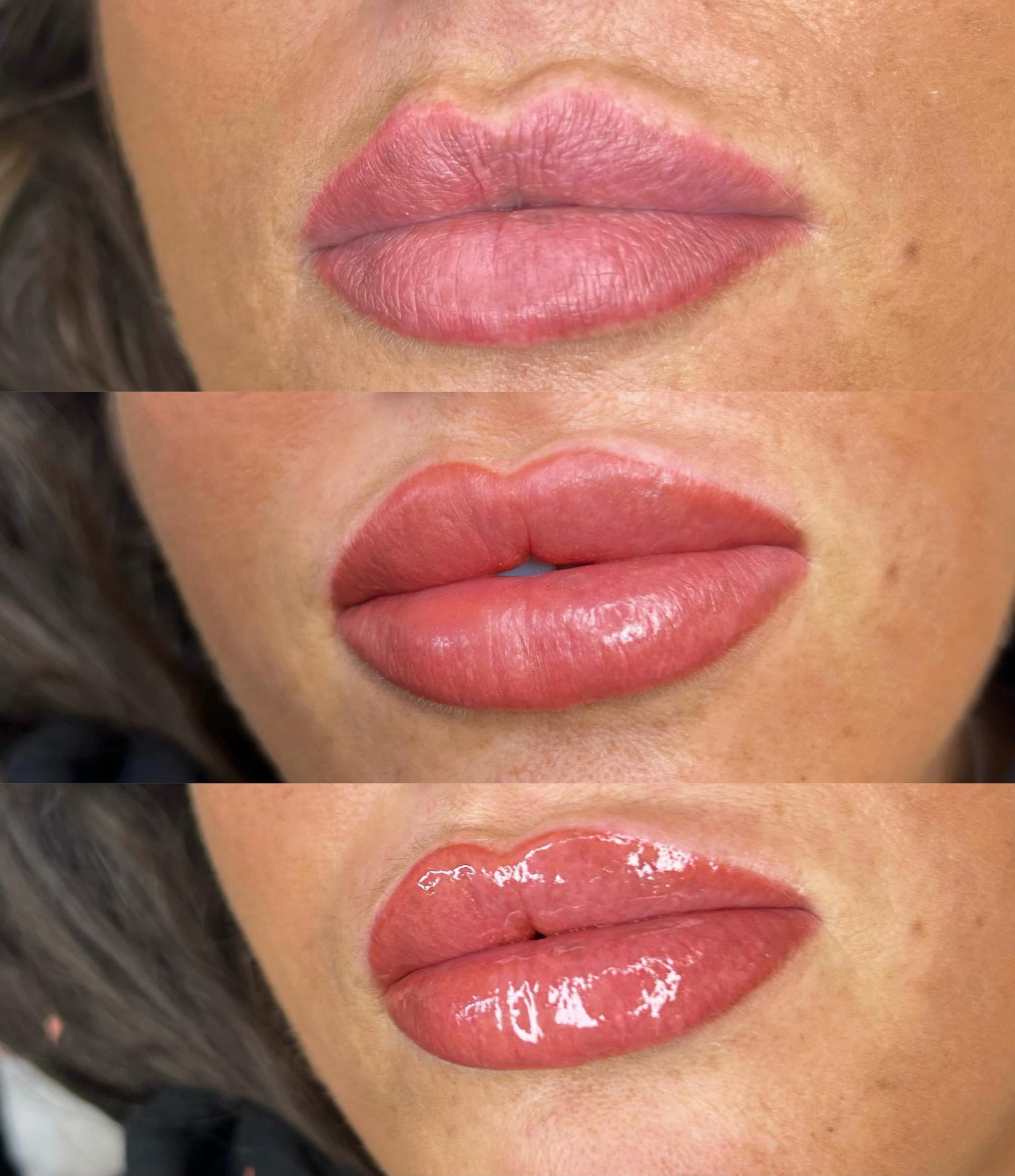 Rs beauty clinic image 1