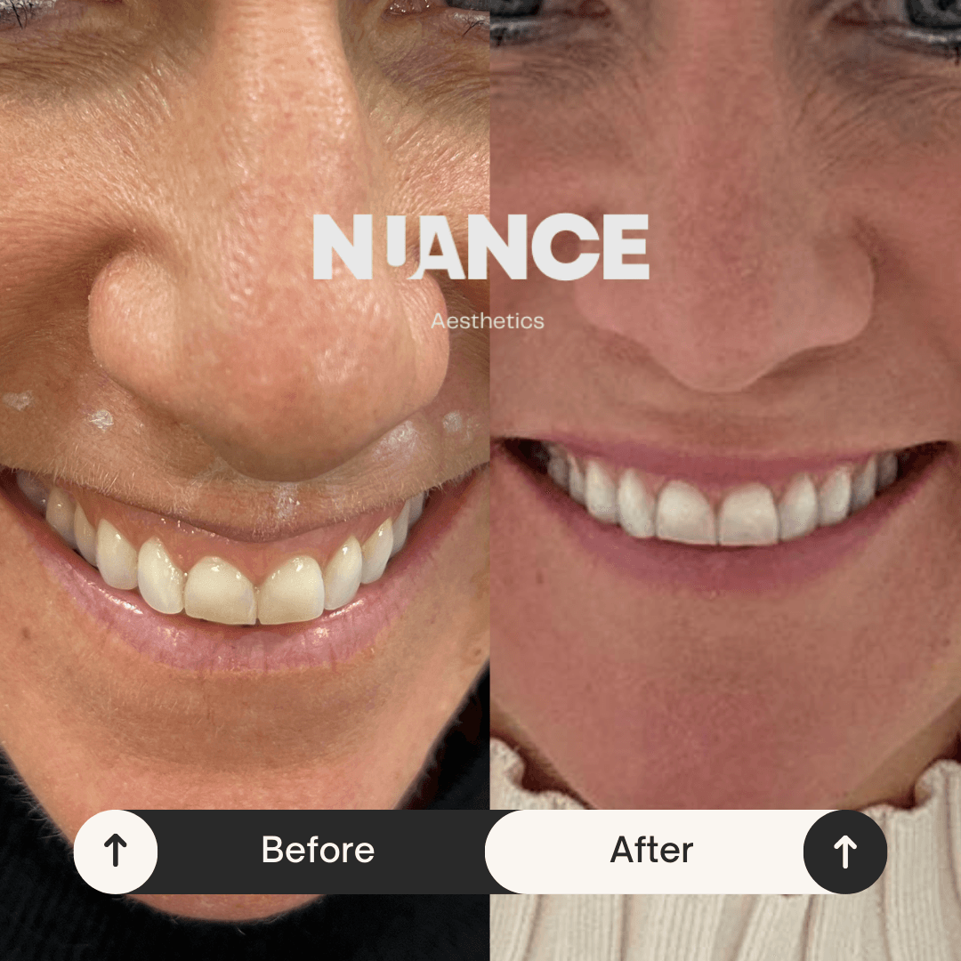 Nuance Aesthetics - Sidcup, Kent image 1