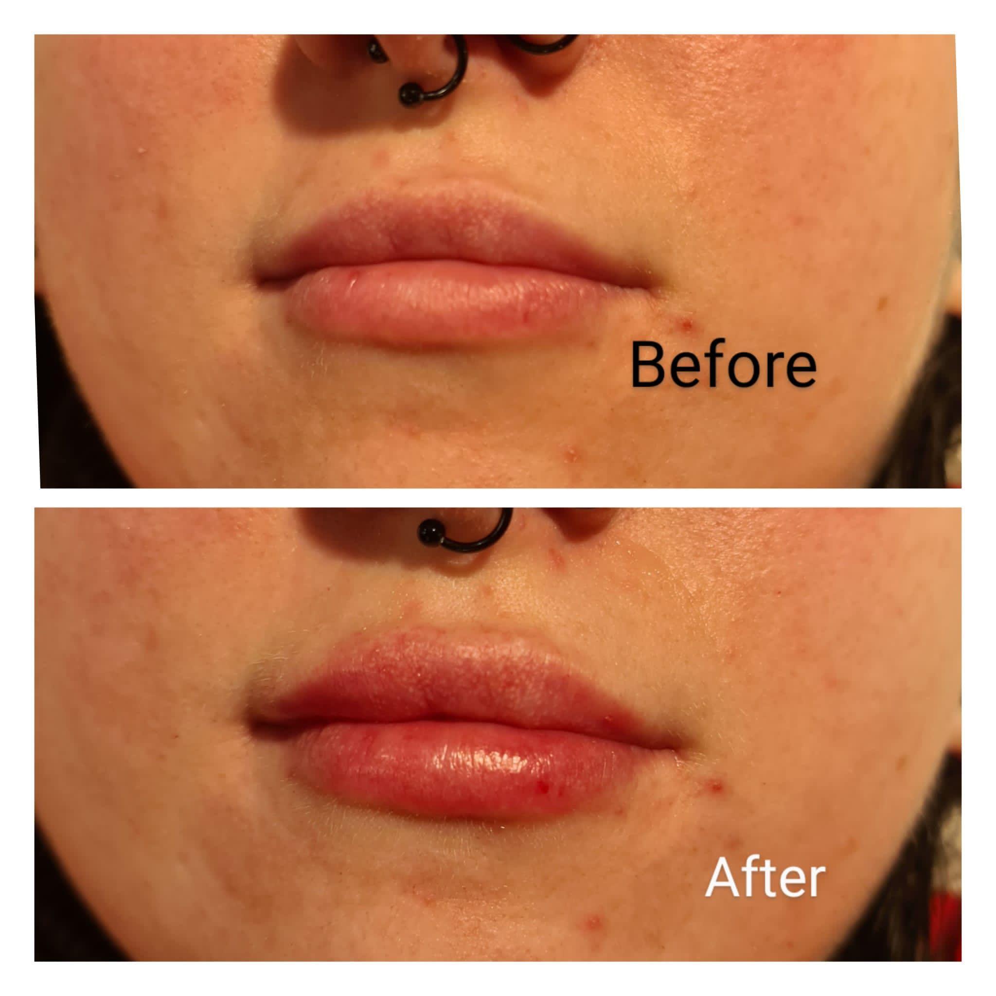 Exquisite Laser Clinic and Nail Bar image 2