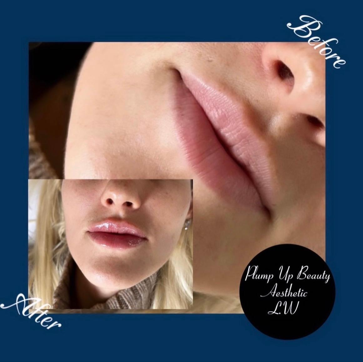 Plump Up Beauty Aesthetic image 2