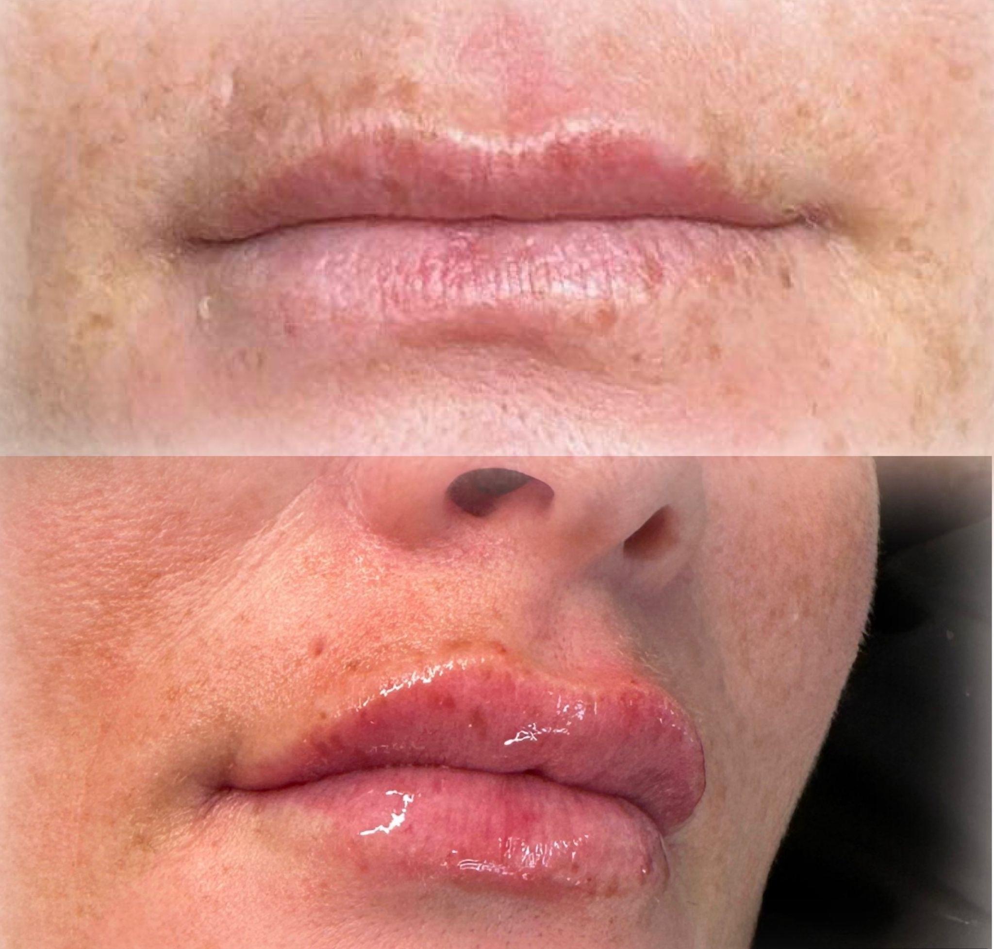 Plump Up Beauty Aesthetic image 3