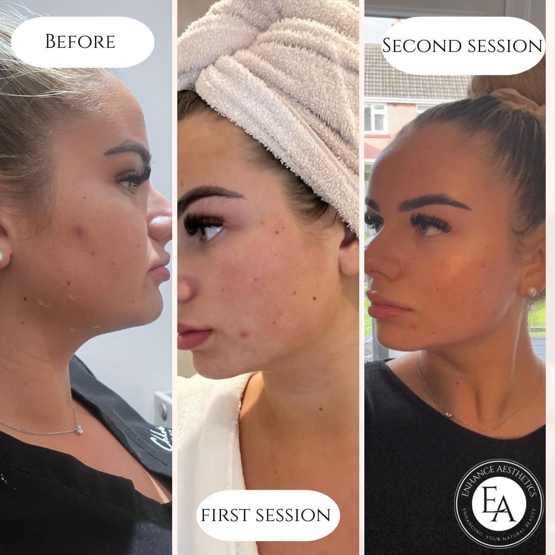 Enhance aesthetics image 2
