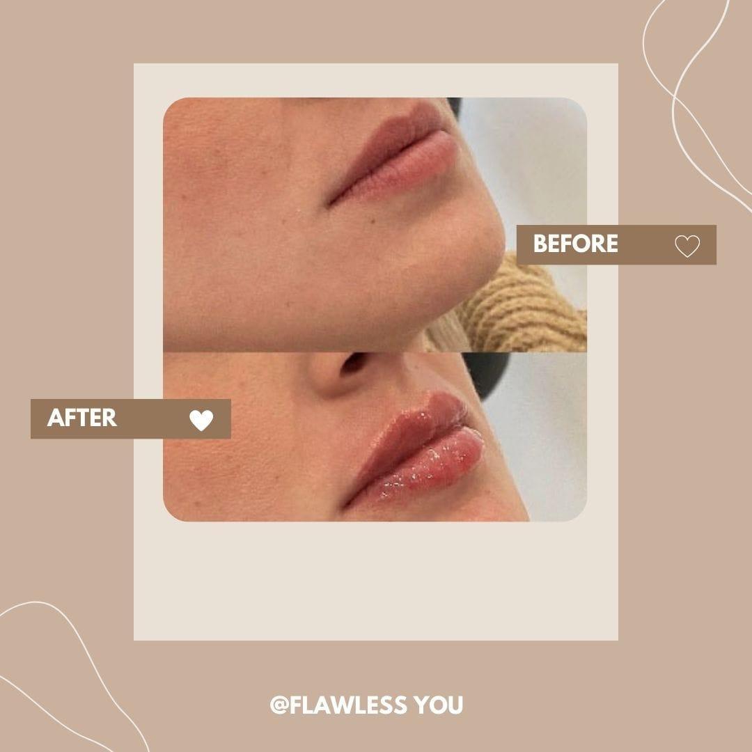 Flawless you image 1