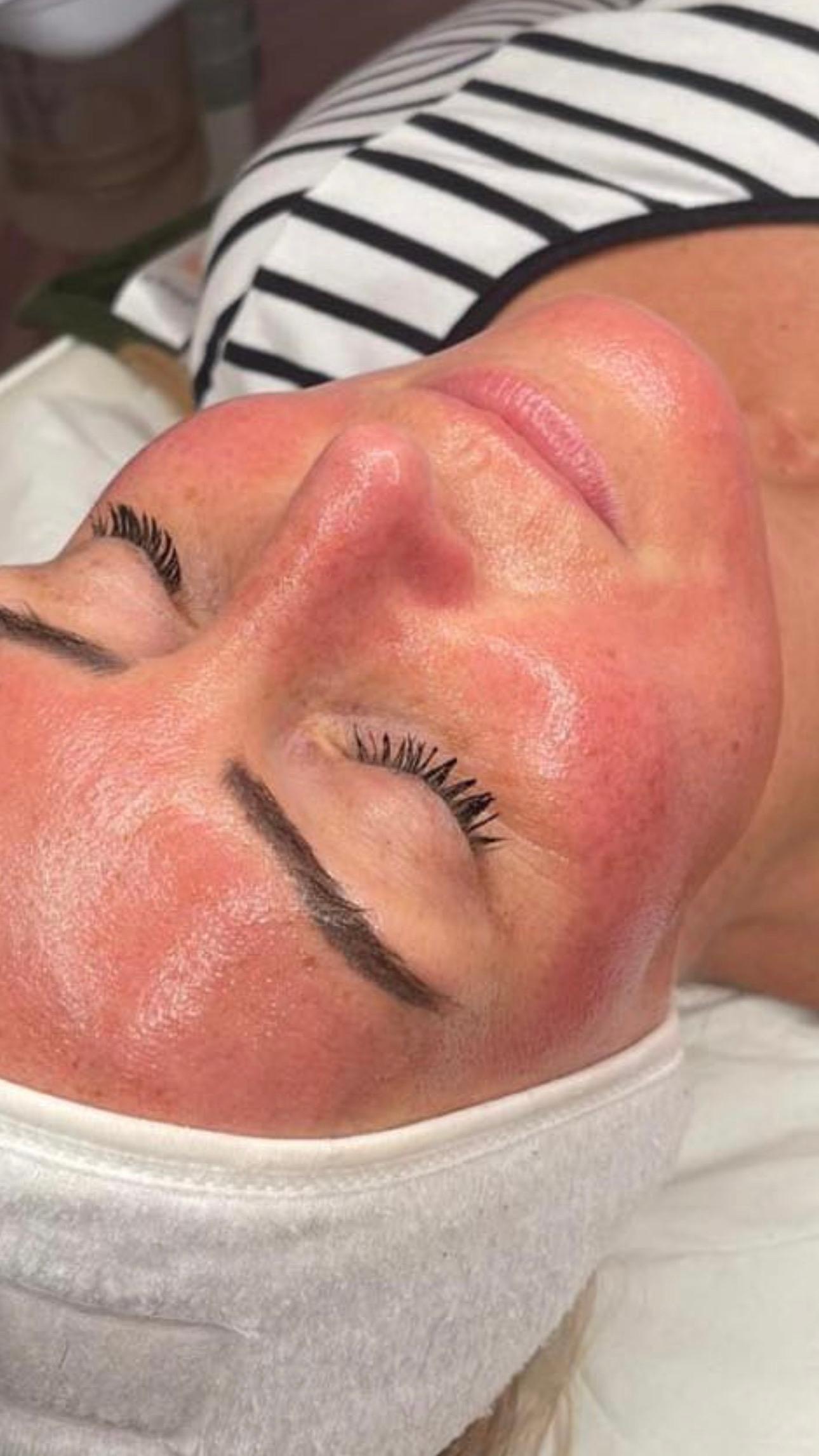 Rejuvaclinic Nurse Led Aesthetics image 1
