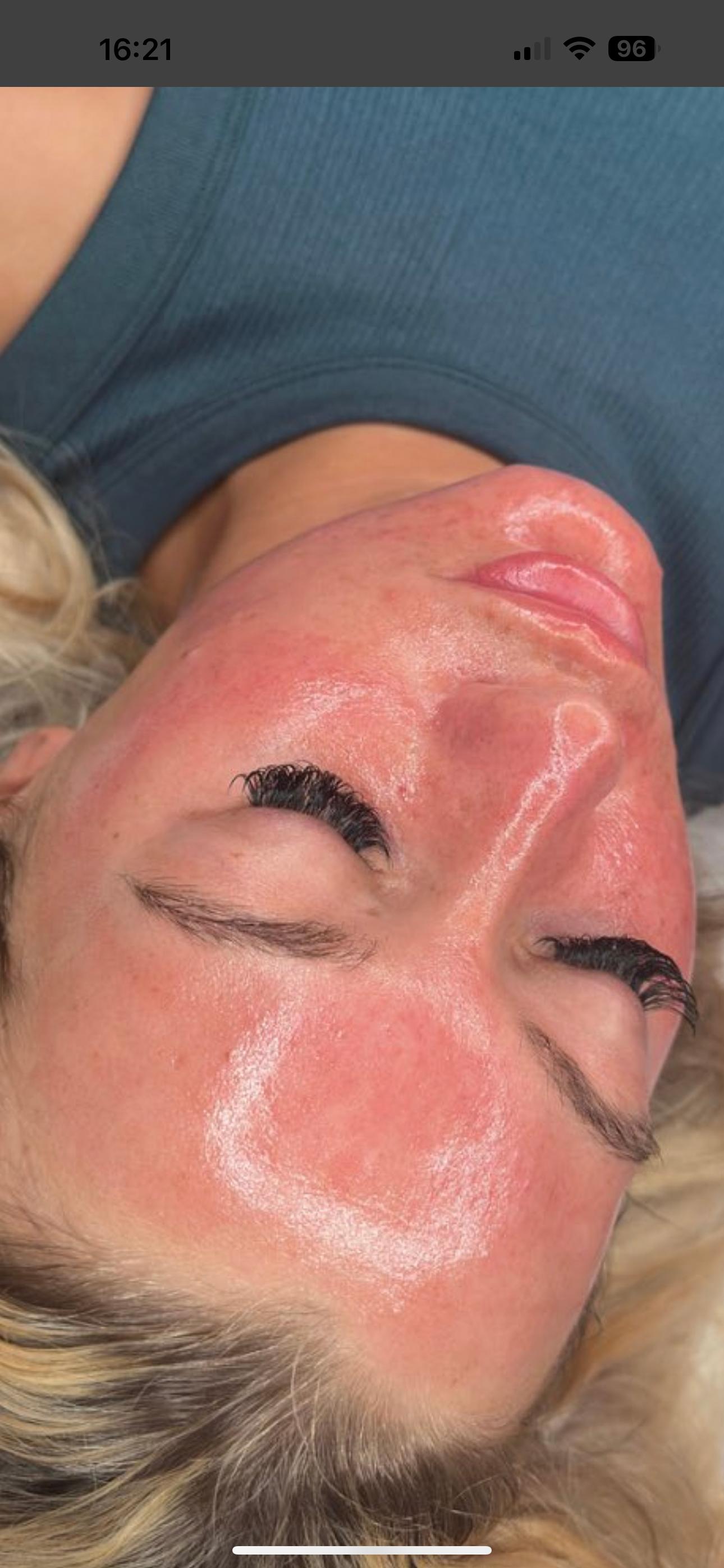 Rejuvaclinic Nurse Led Aesthetics image 2
