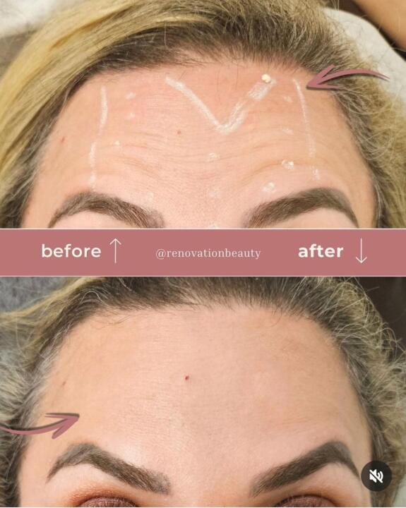 Michelle Renovation Beauty image 1