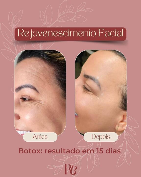 Michelle Renovation Beauty image 2