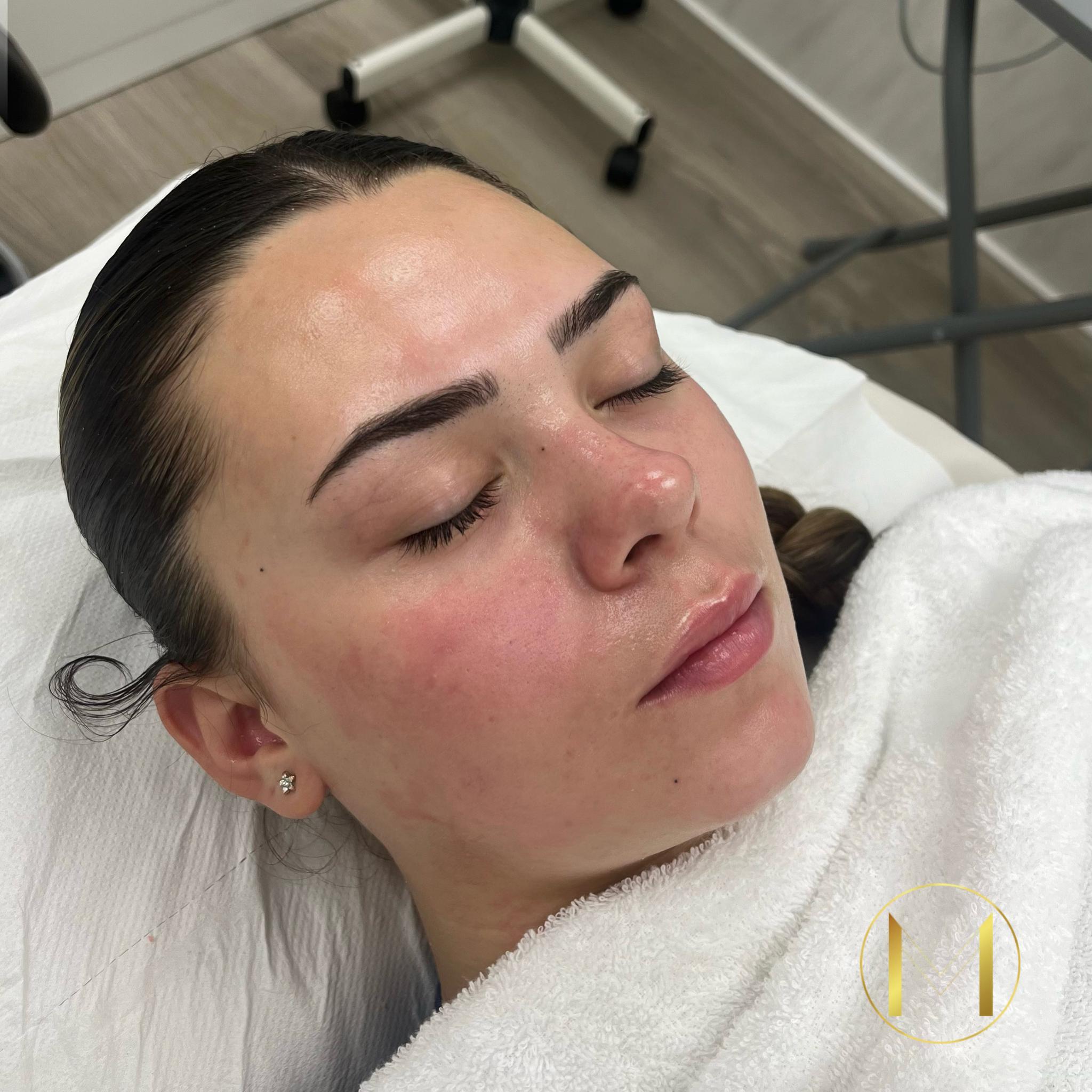 Mlaaesthetics image 3