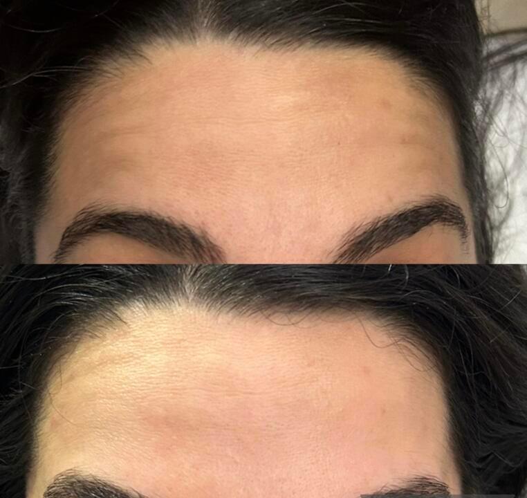 Beauty clinic Brazzini image 1