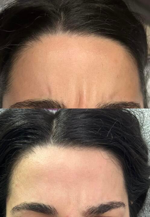 Beauty clinic Brazzini image 2