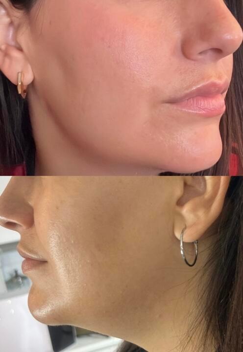 Beauty clinic Brazzini image 3