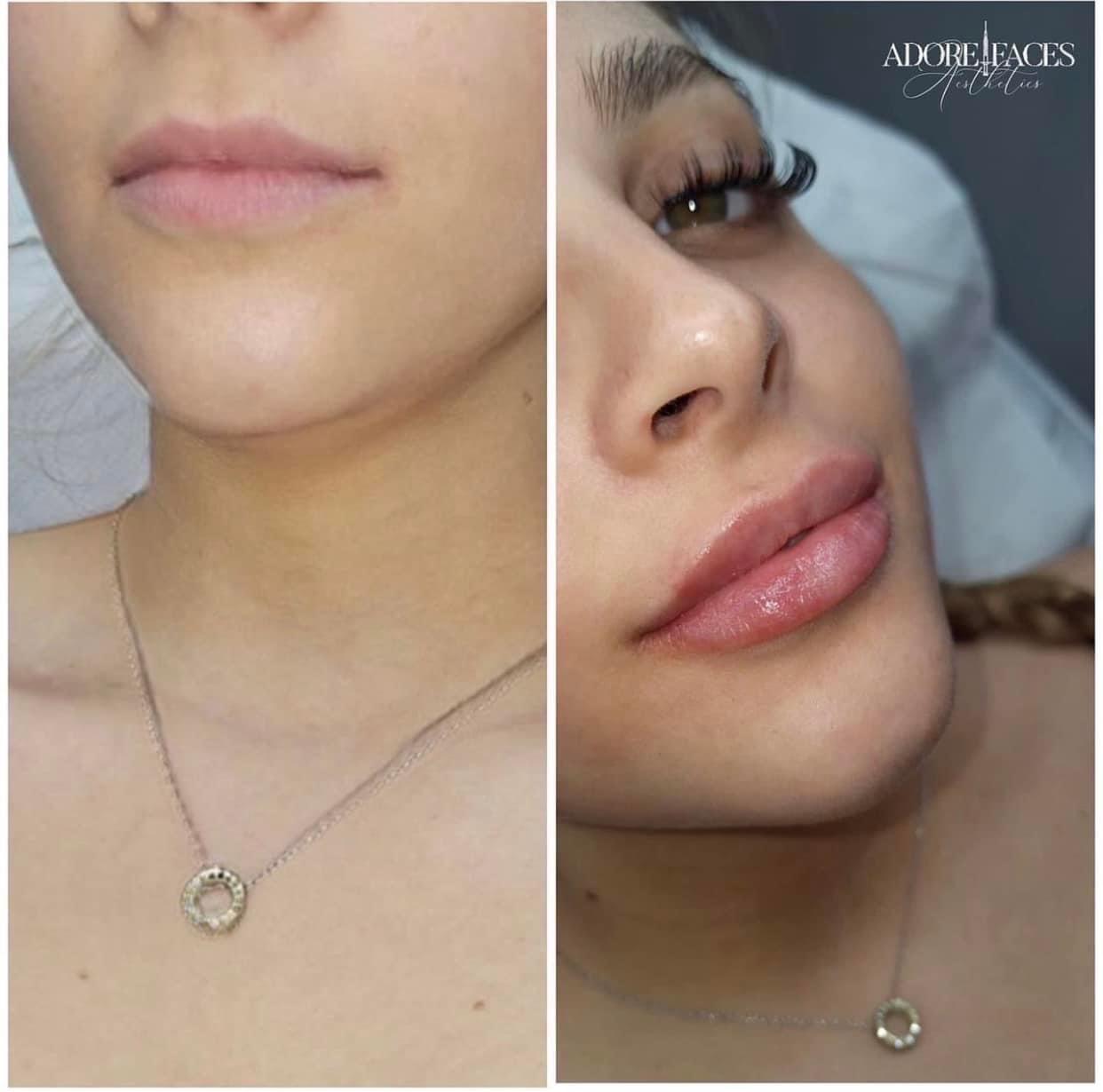 Adore Aesthetics and Skincare image 3