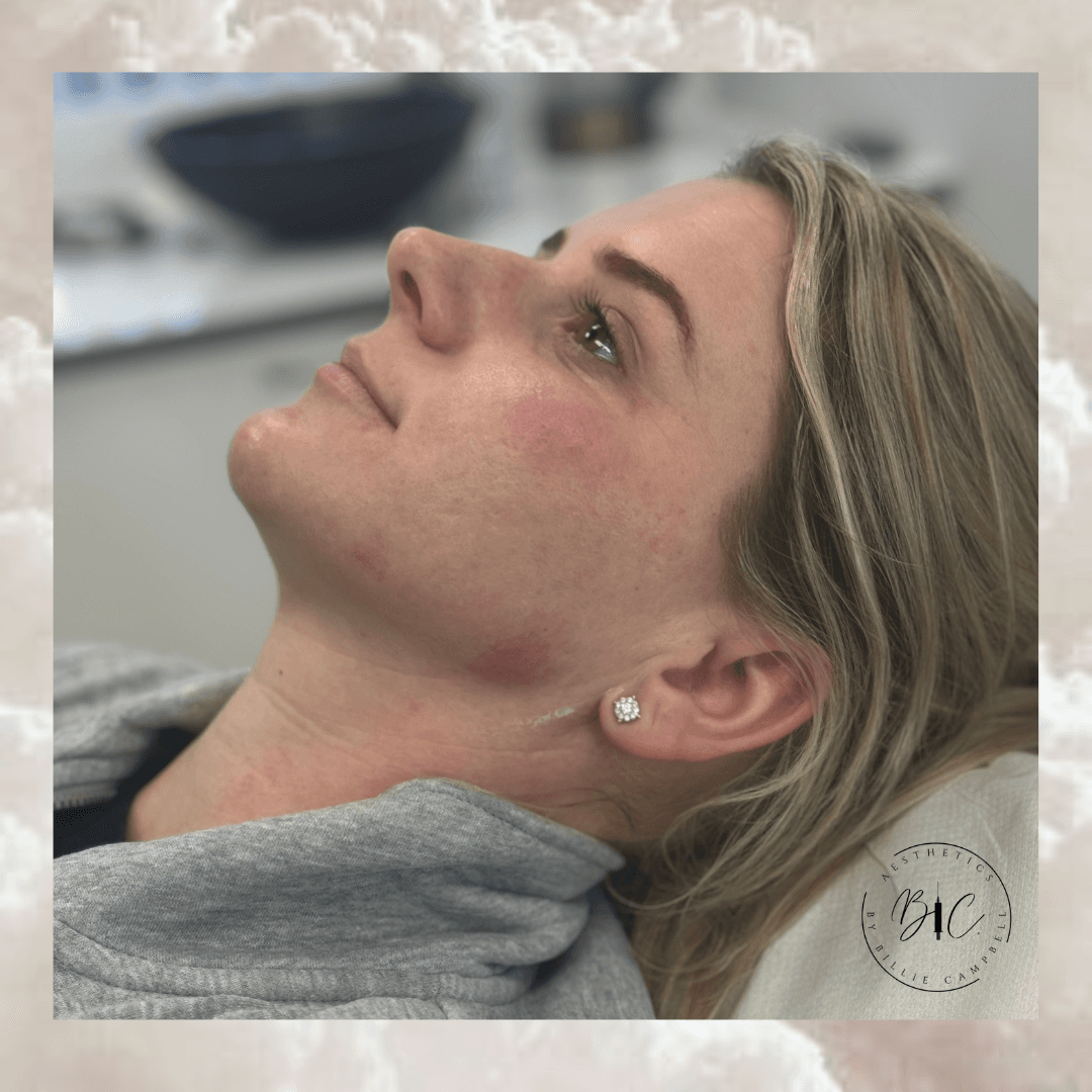 Hera Salon - Aesthetics by Billie image 3