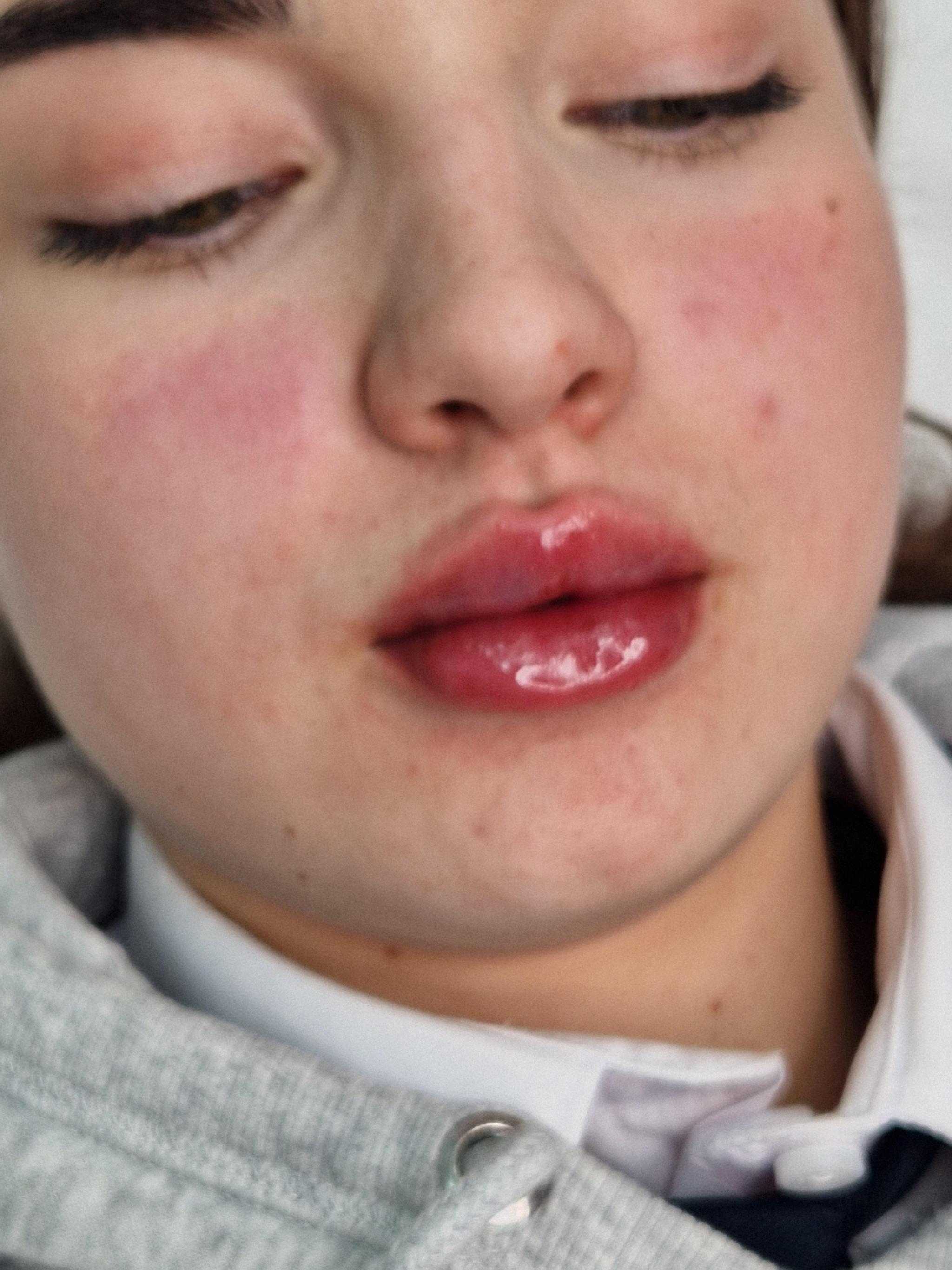 Pamper image 1
