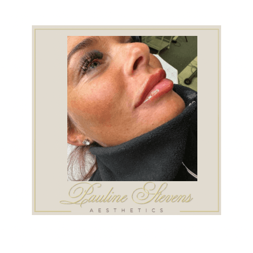 Pauline Stevens Aesthetics image 3