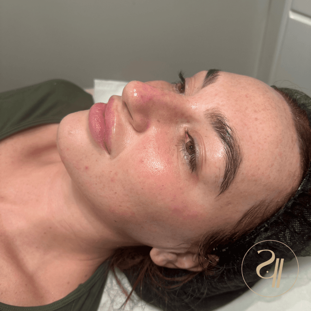 Skin is in image 3