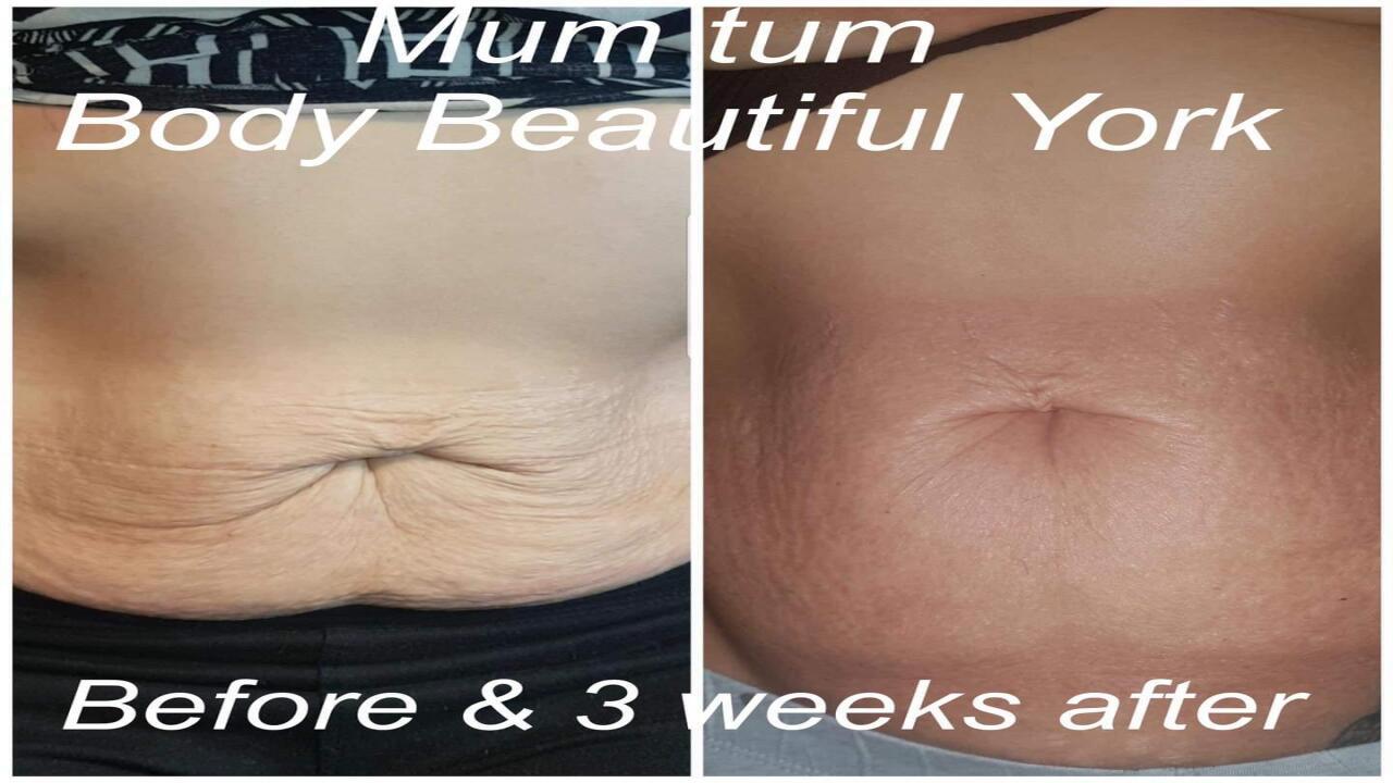 Body Beautiful York image 3