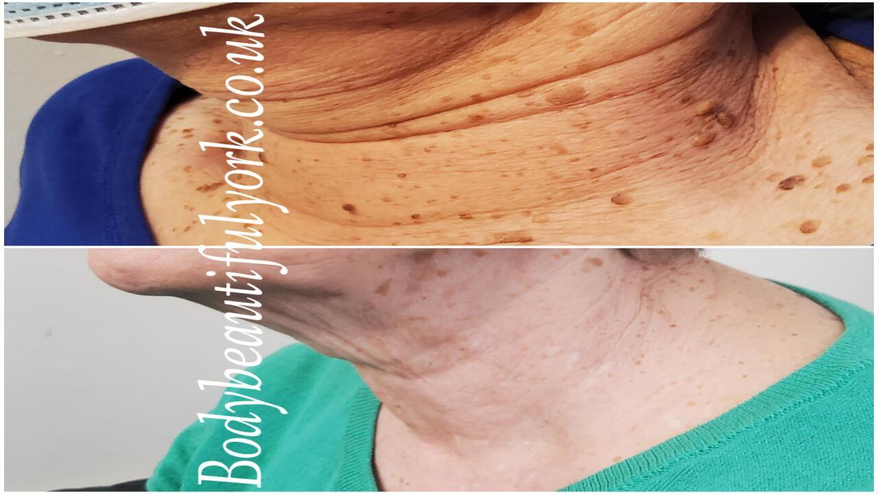 Body Beautiful York image 2