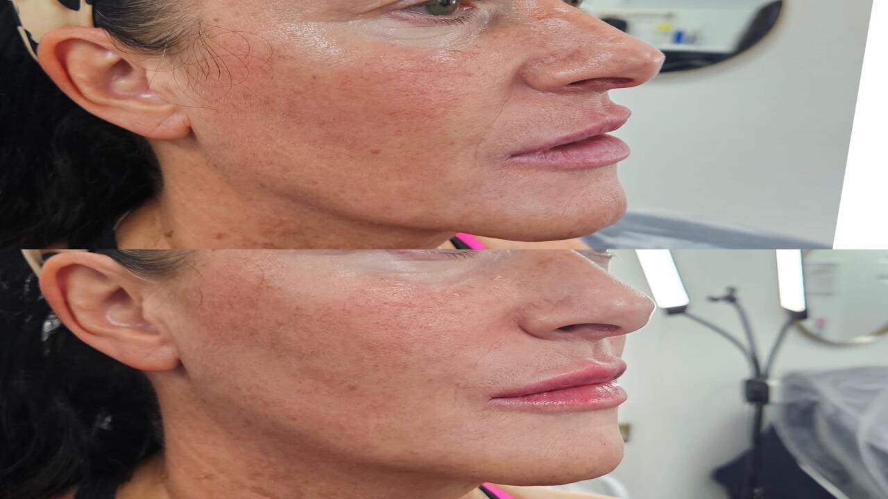 Aquarius Aesthetics Clinic image 3
