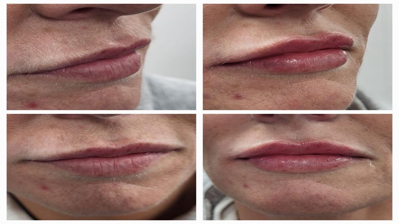 Aquarius Aesthetics Clinic image 2