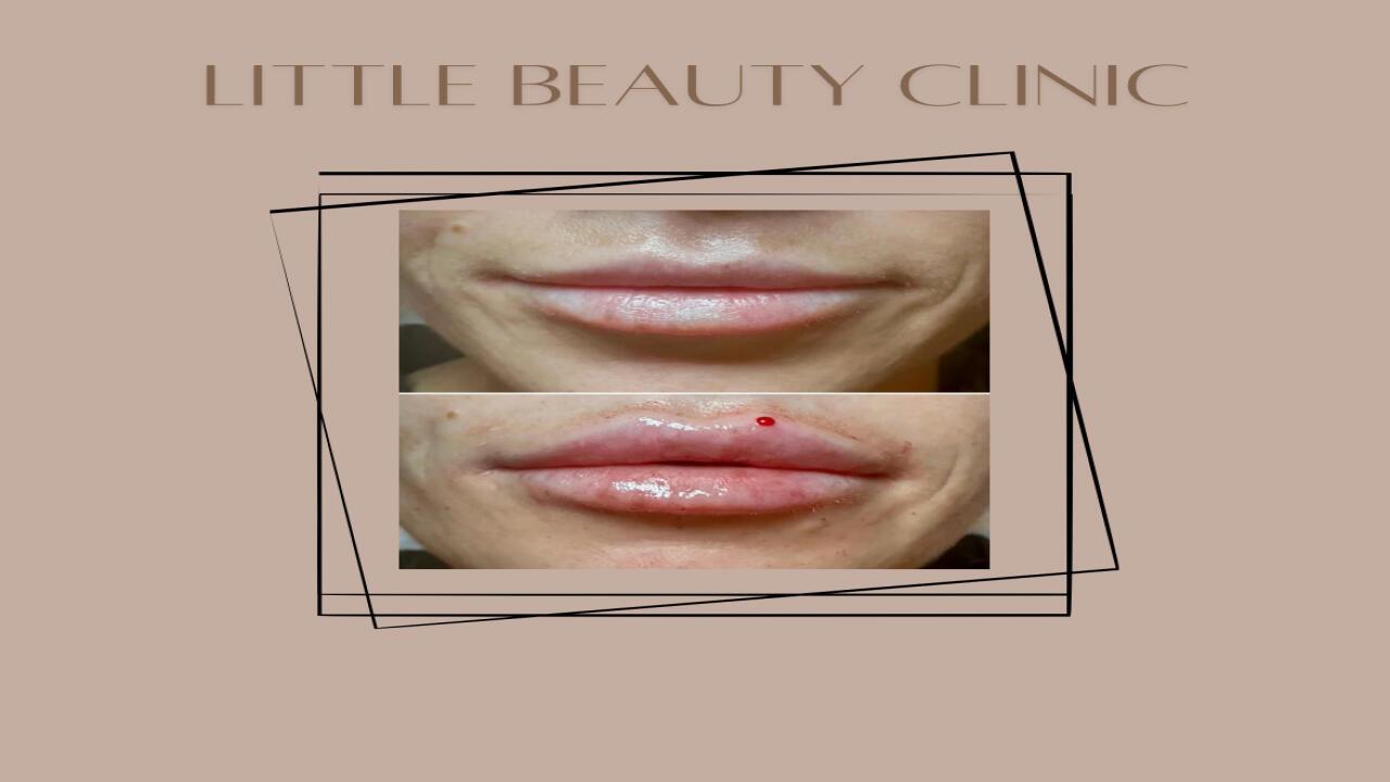 Little Beauty Clinic image 2