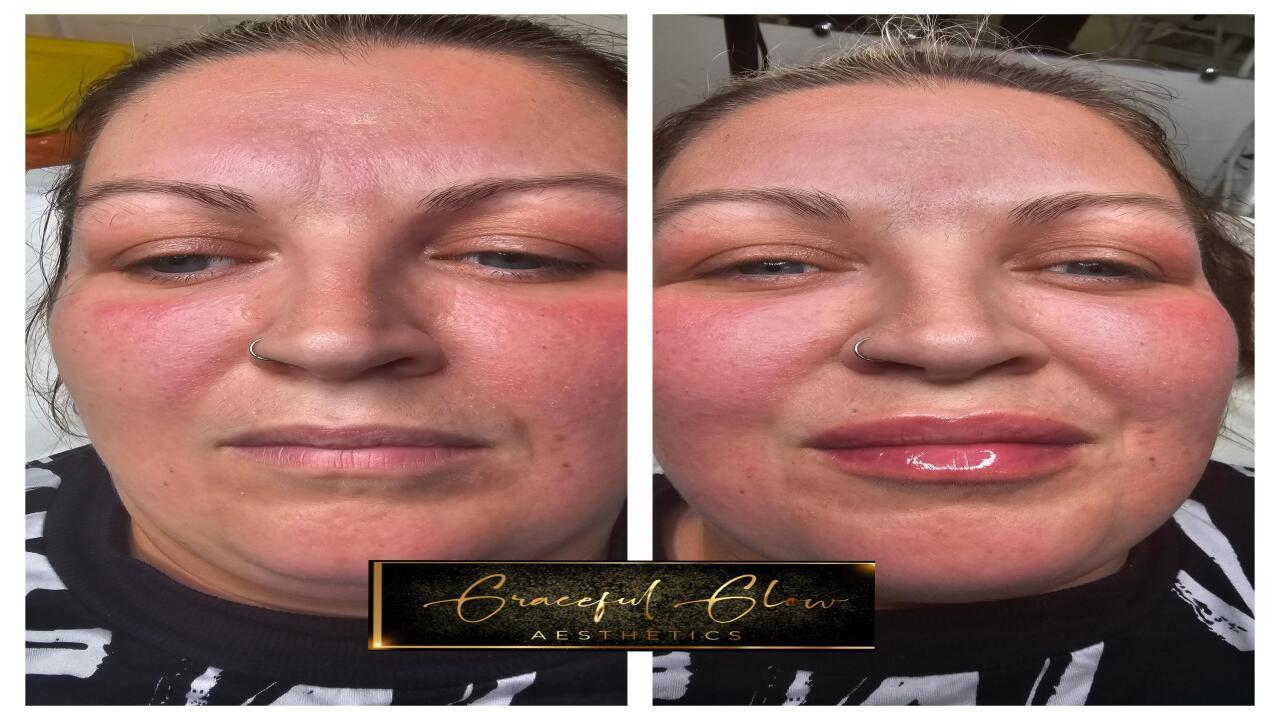 Graceful glow aesthetics image 2