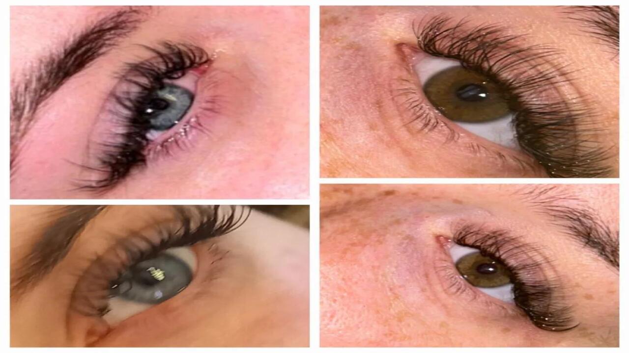 BLYNK BEAUTY image 2