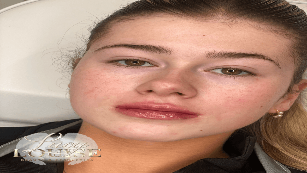 Lucy Louise Beauty and Aesthetics image 3