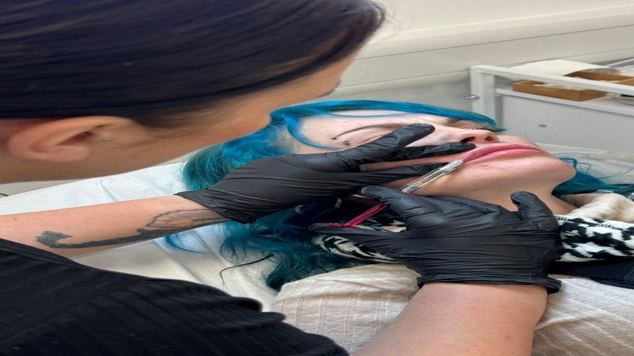 CHLOES image 3