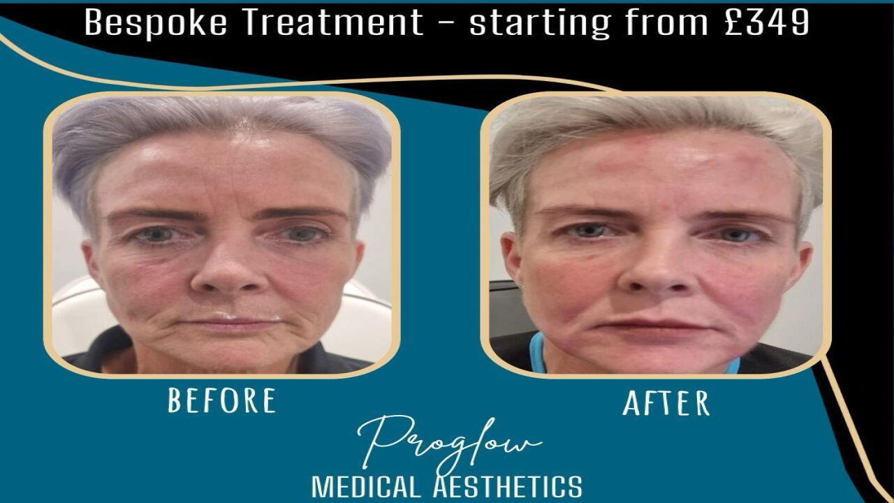 Pro Glow Medical image 2