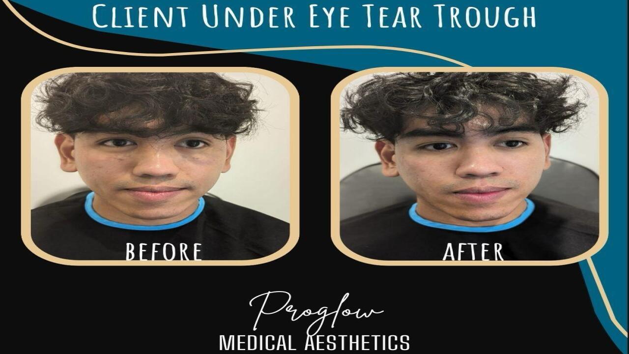 Pro Glow Medical image 3