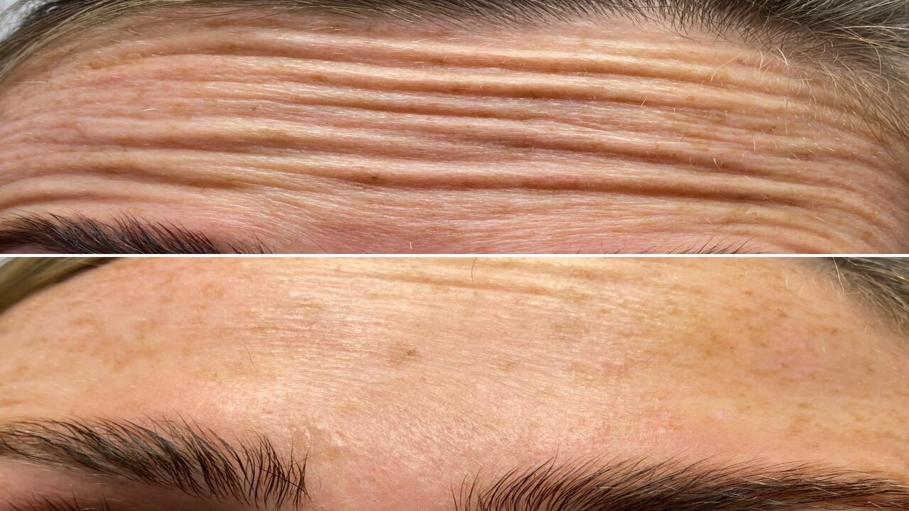 Pure Aesthetics image 2