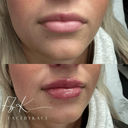Facebykace image 1