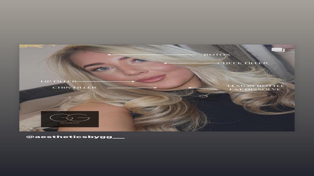 Aesthetics by GG image 2