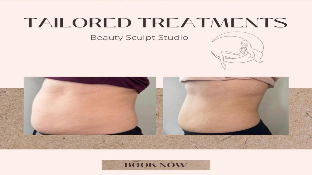 The Beauty Sculpt image 2