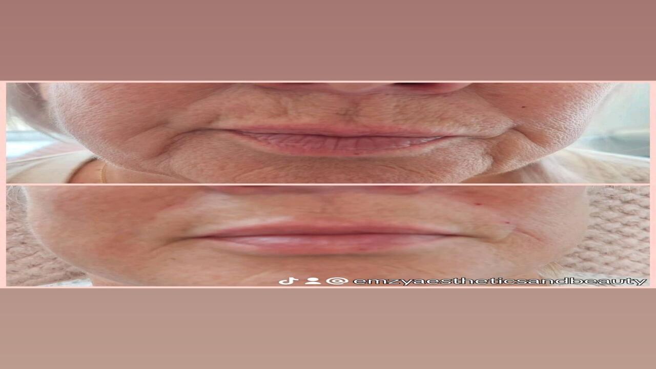 Emzy Aesthetics and Beauty image 1