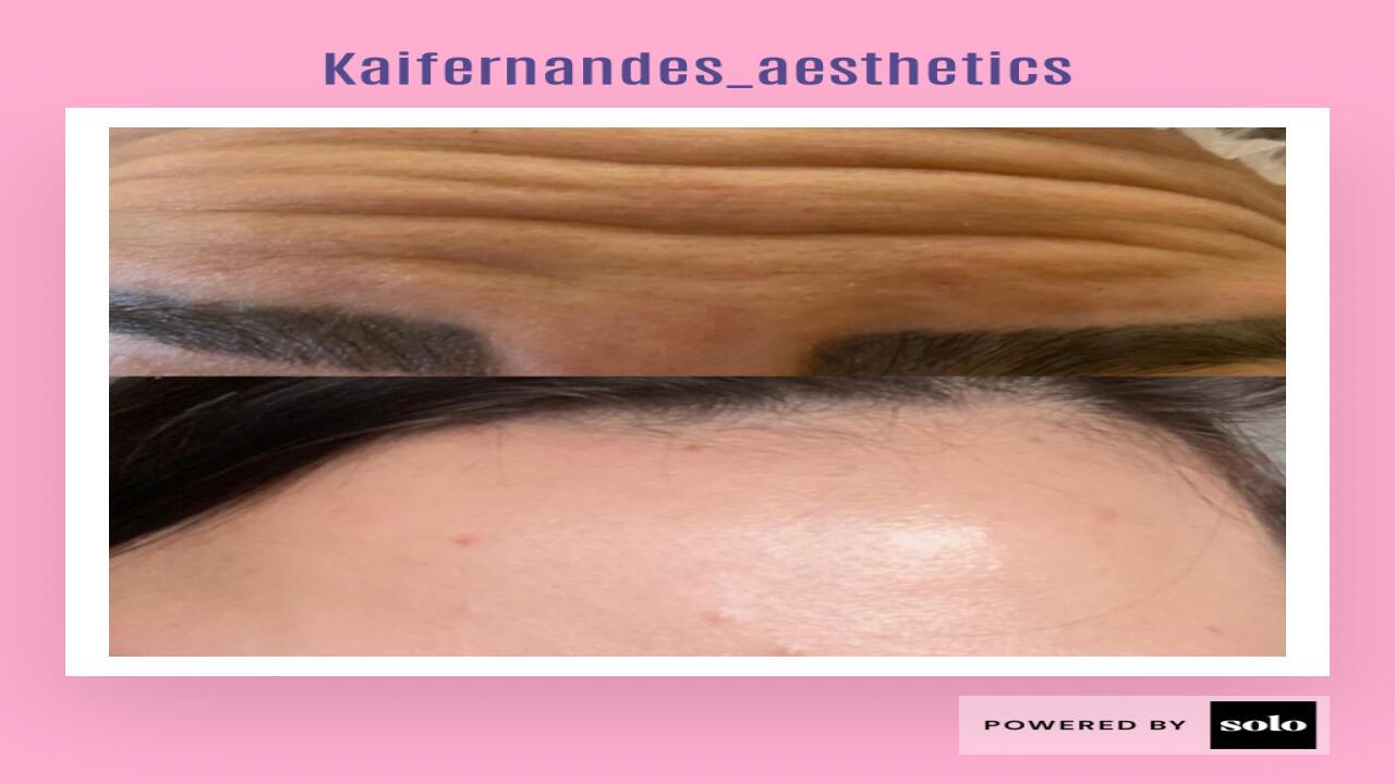 Karine image 1