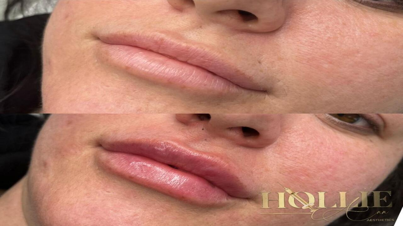 Hollie Ann Aesthetics image 1