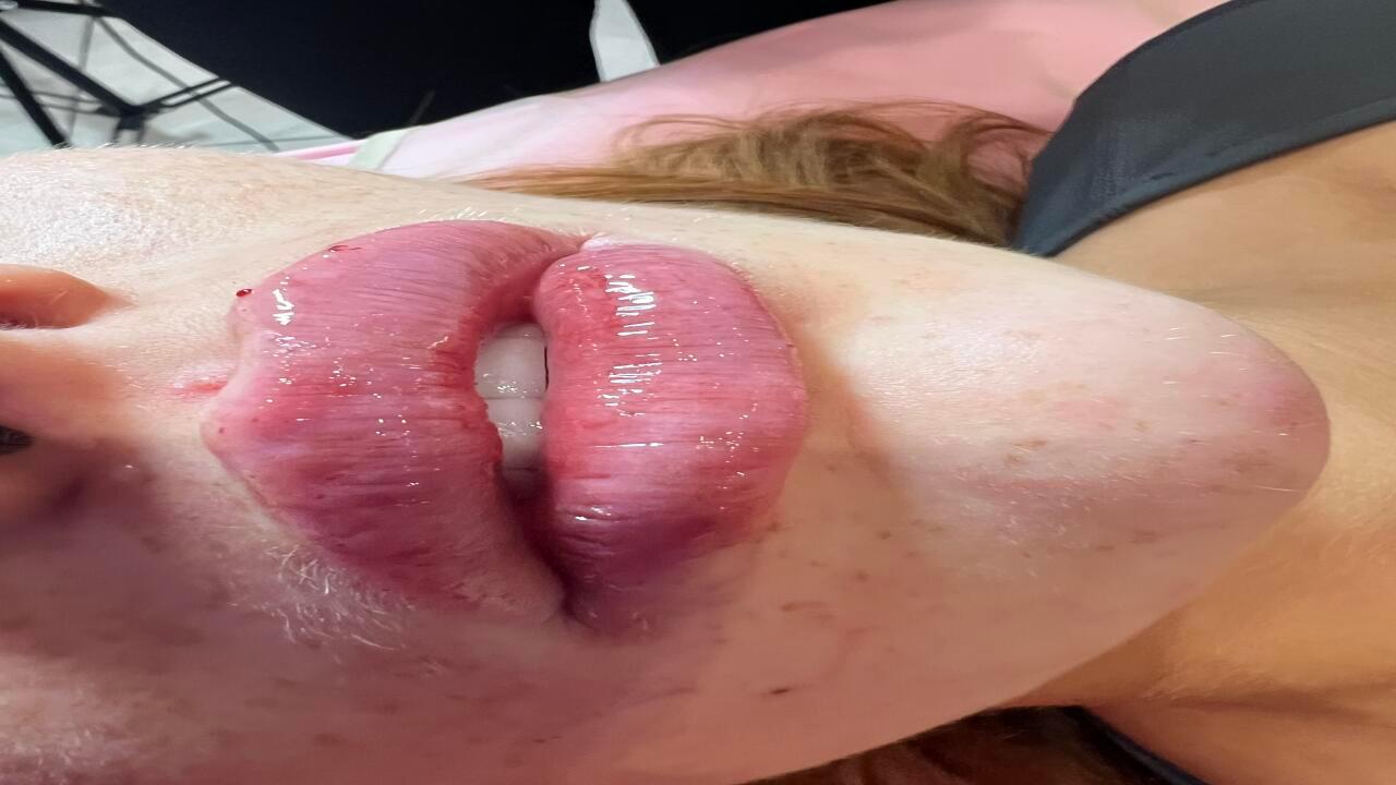 FaceofPorcelain image 2
