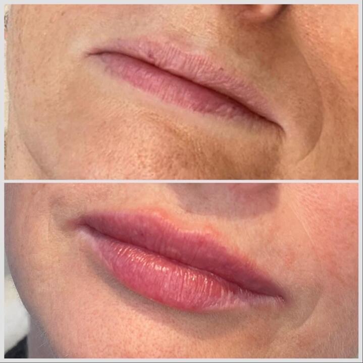 Epiderme Aesthetics Cheshire image 2