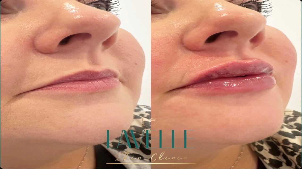 Lavelle Skin Clinic image 3
