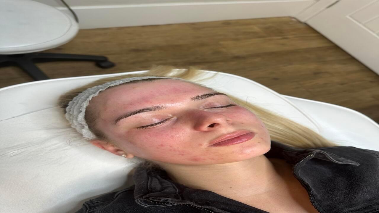 GLOw Skin image 2