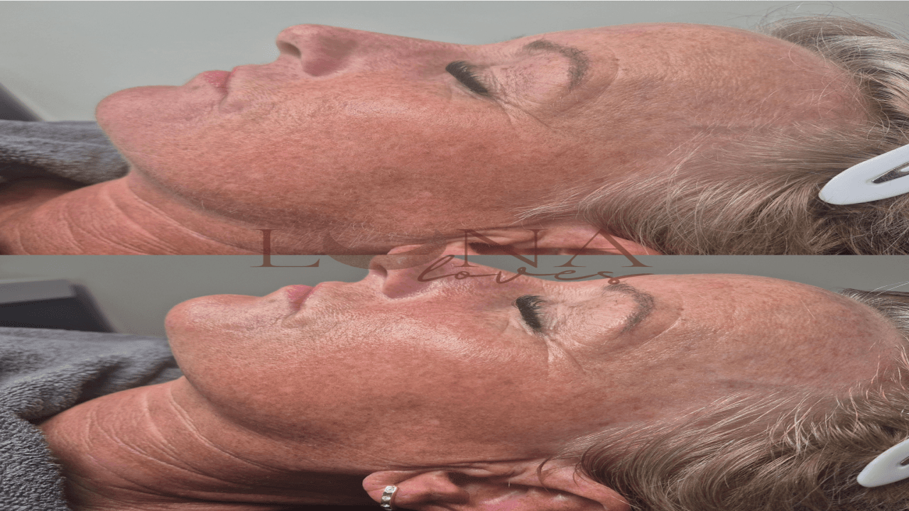 LunaLoves X image 2
