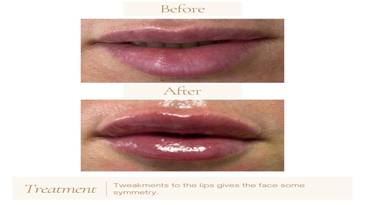 Aesthetics and Beauty Solihull image 3