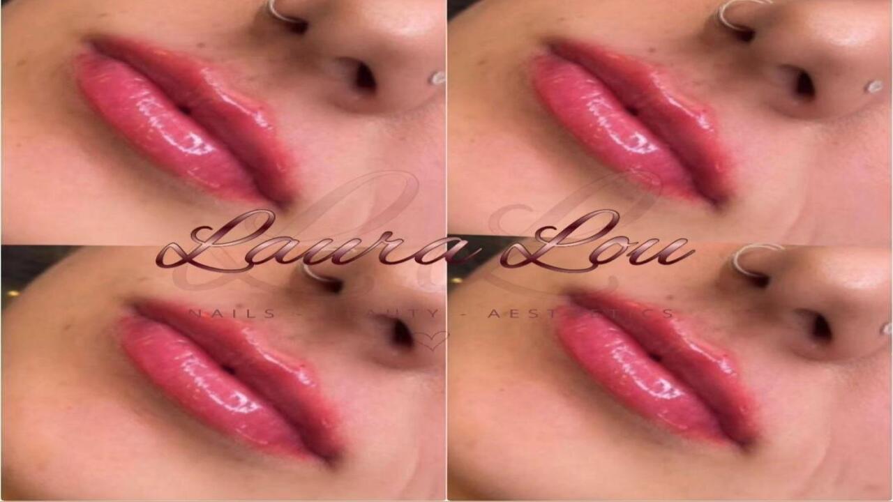 Laura Lou Treatments image 3