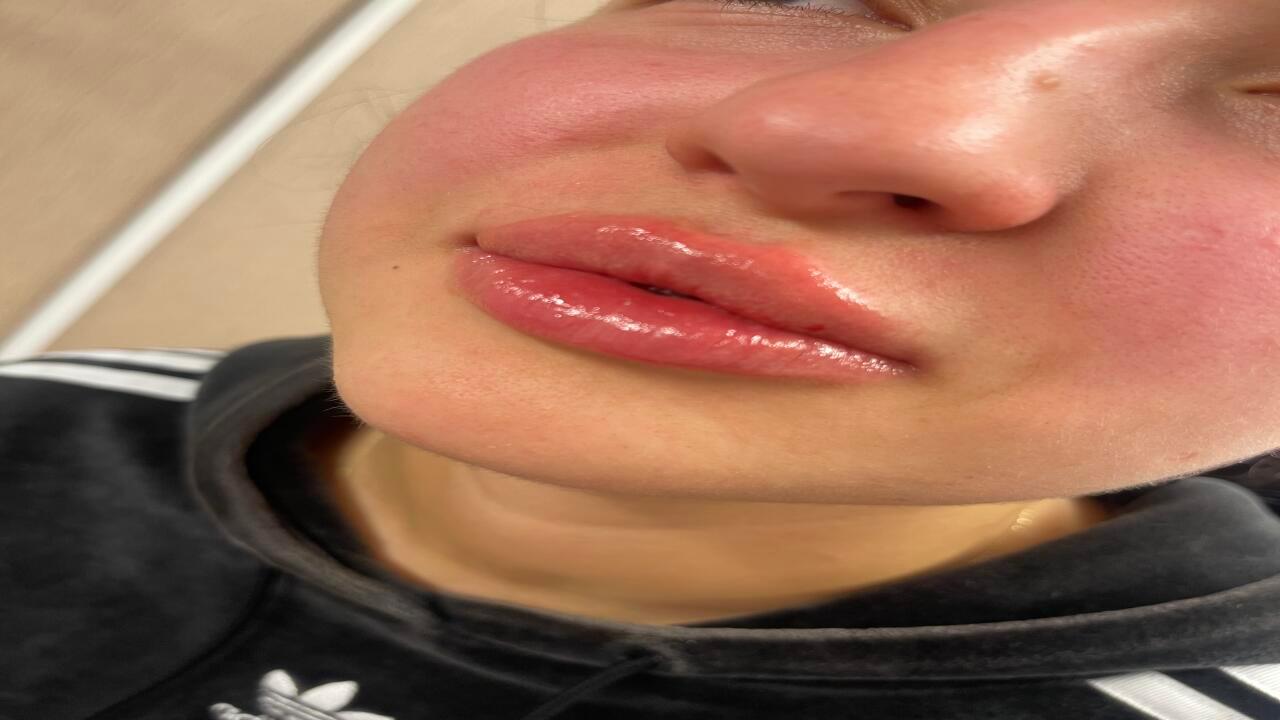 PrettyPremonitional image 2