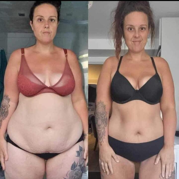 Sculptsure Ltd image 1