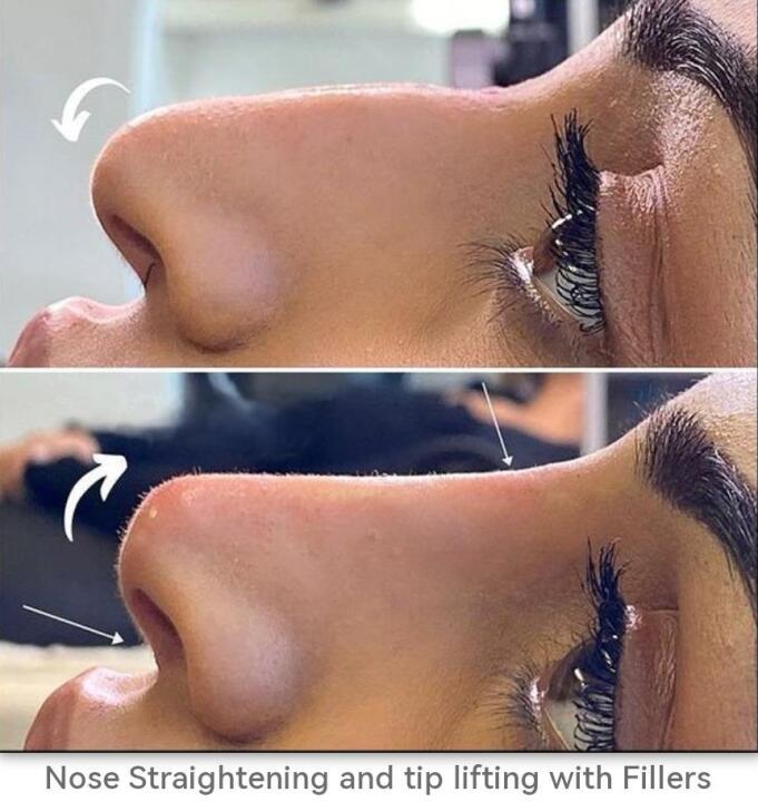 Sculptsure Ltd image 2